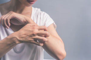 Woman scratches her arm, bothered by dry skin than may be a sign of a larger condition