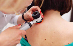 Dermatologist studies woman's back to determine if she has skin cancer.